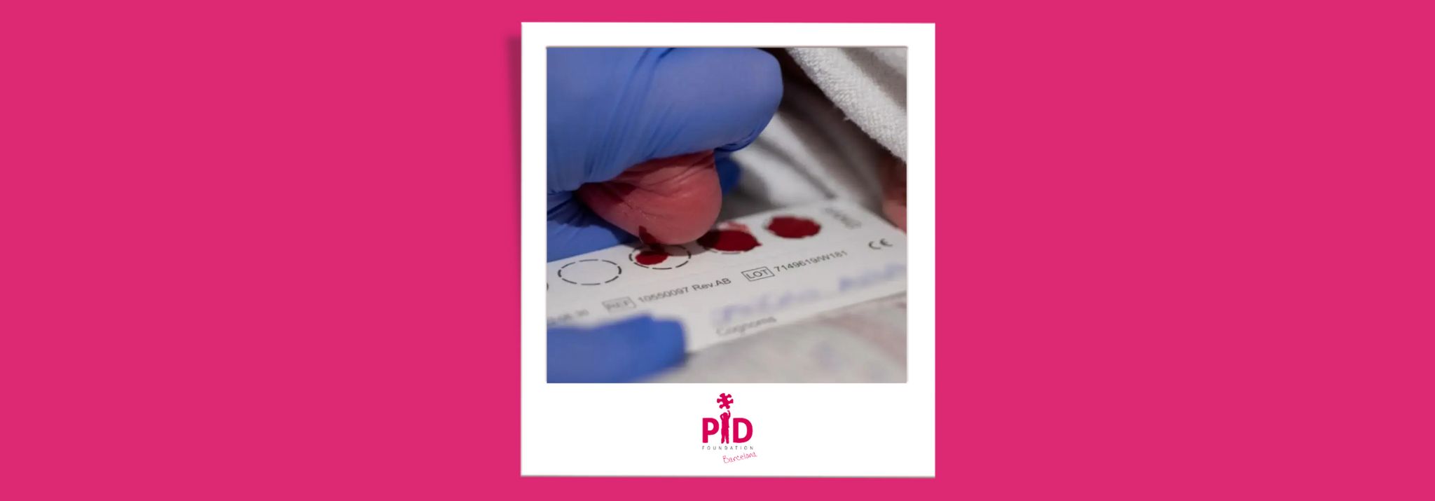 Newborn screening identifies Madrid’s first SCID case